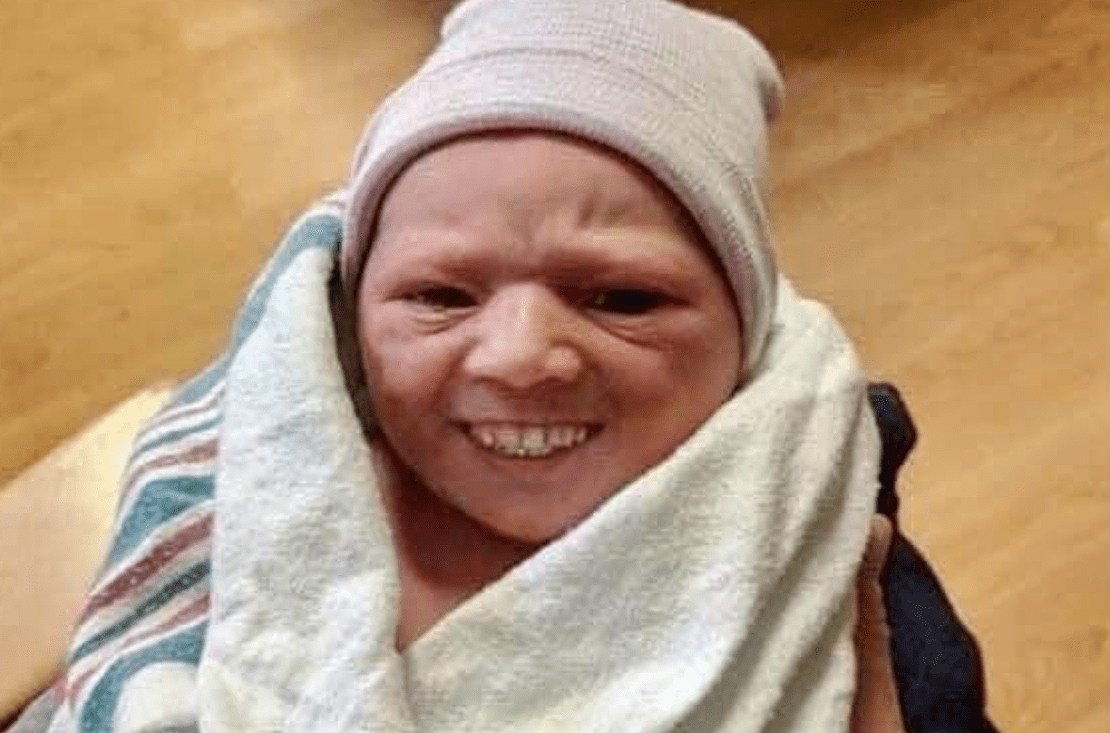 disturbing-photos-of-babies-with-grown-up-teeth-you-ve-been-warned